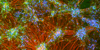 Neurons photo by Nick Blair