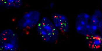 Sandhoff disease gene therapy