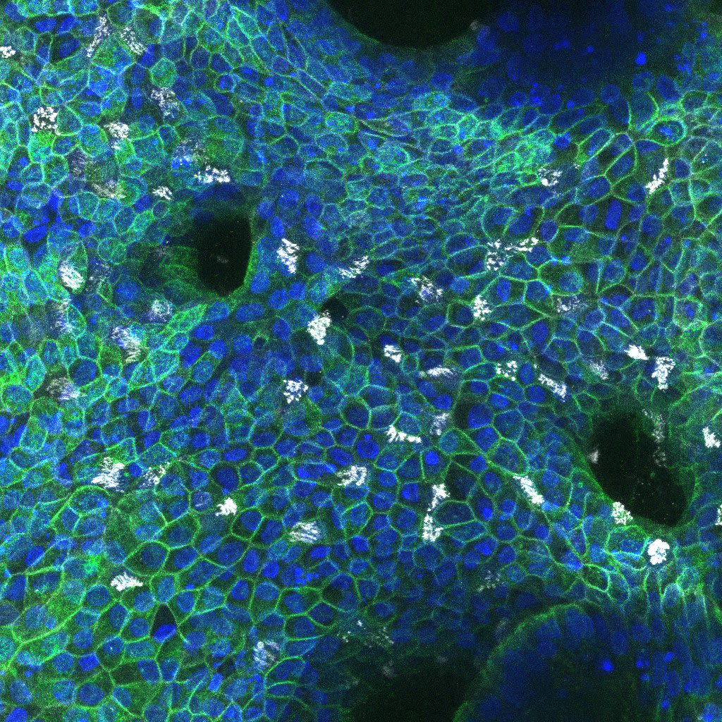 Model of the human endometrium, generated using endometrial organoids and stromal cells
