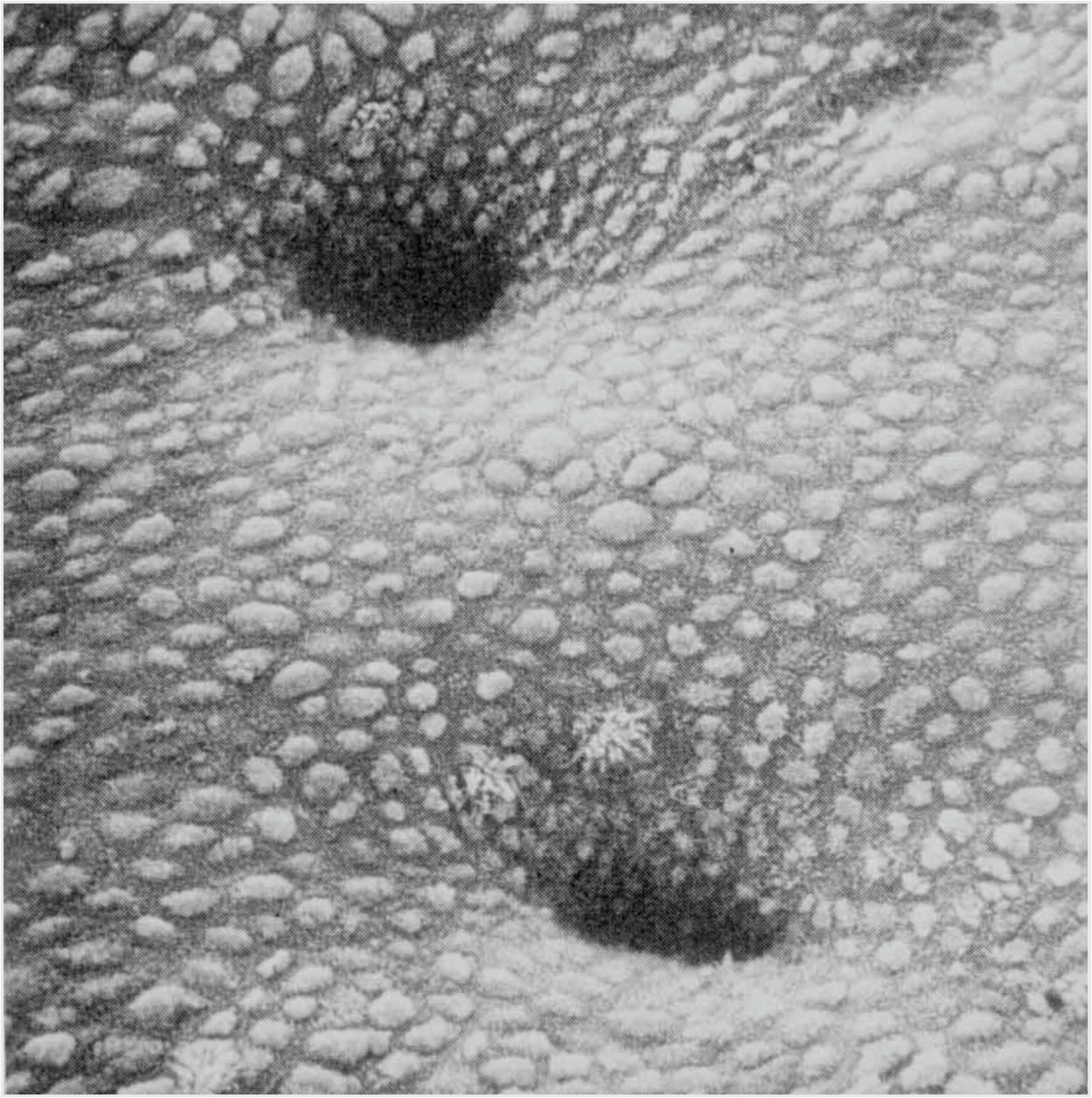  image showing human endometrial surface in vivo