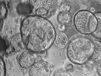human mini-organs - organoids - growing in culture