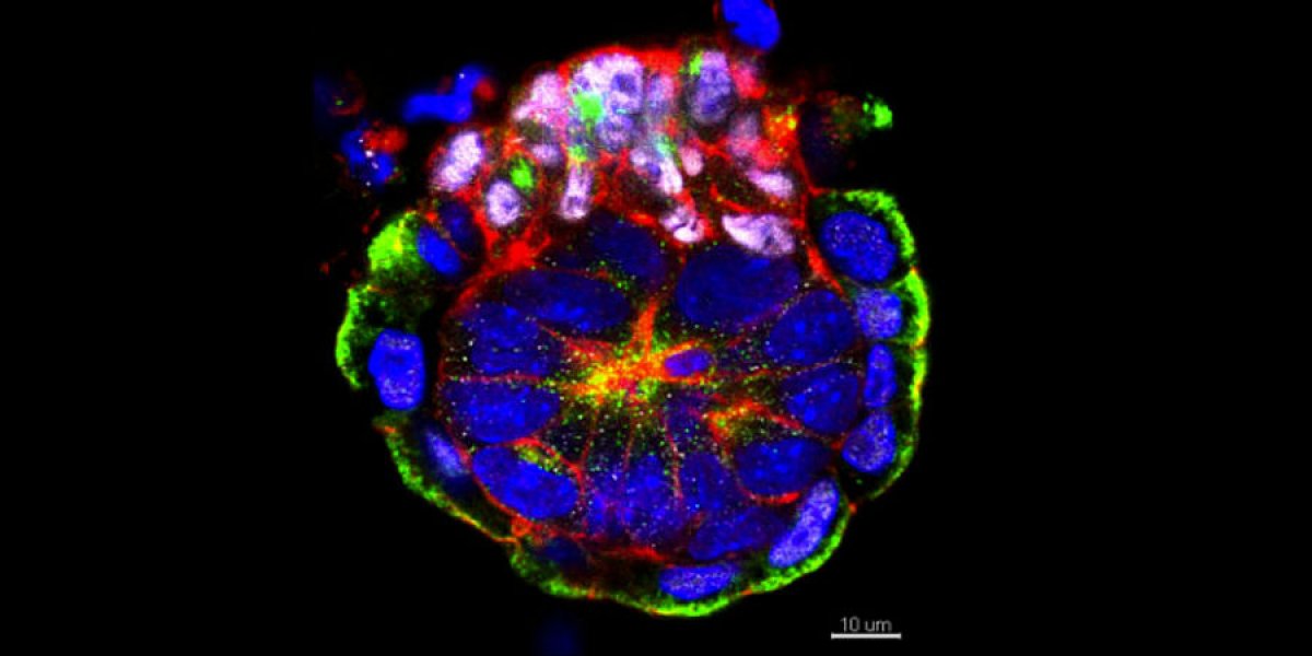 Implantation of an embryo